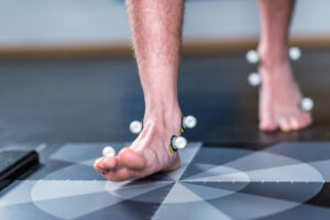 choroba-severa-dzieci-leczenie-bol-piety