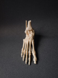 diagnostyka-role-kosci-lodkowatej-plaskostopie