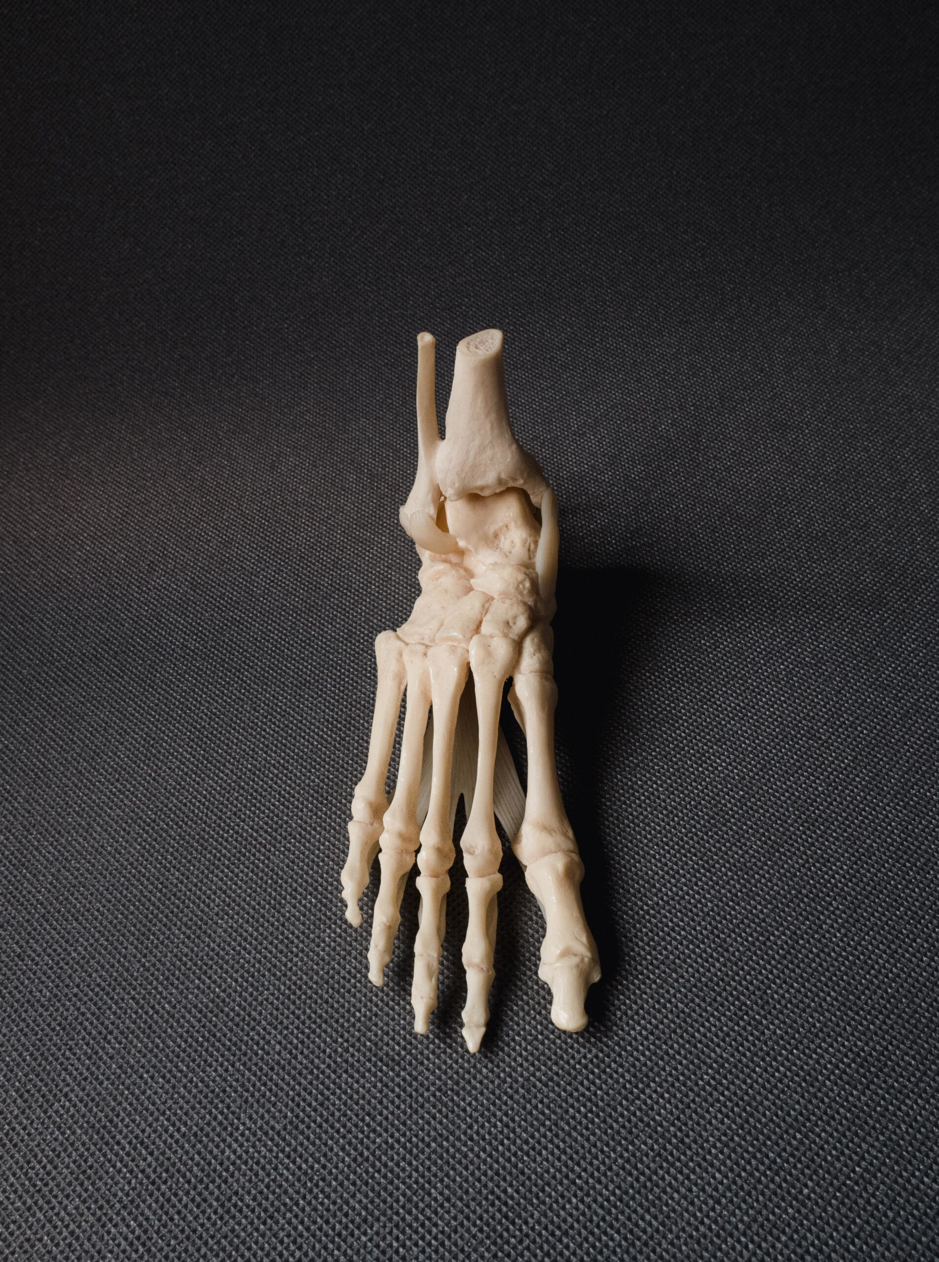 diagnostyka-role-kosci-lodkowatej-plaskostopie